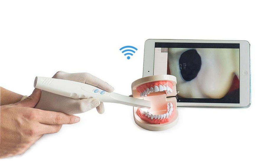 how Intra Oral Camera work