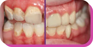 before and after image