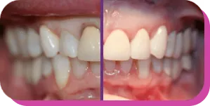 before and after image