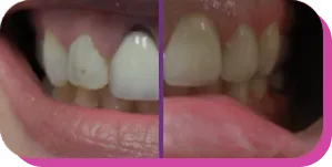 before and after image