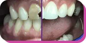 before and after image